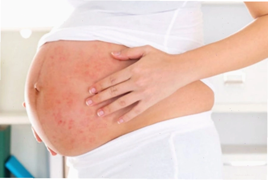 Sốt xuất huyết có thể gây suy tim, xuất huyết não, suy thận nếu không được điều trị kịp thời