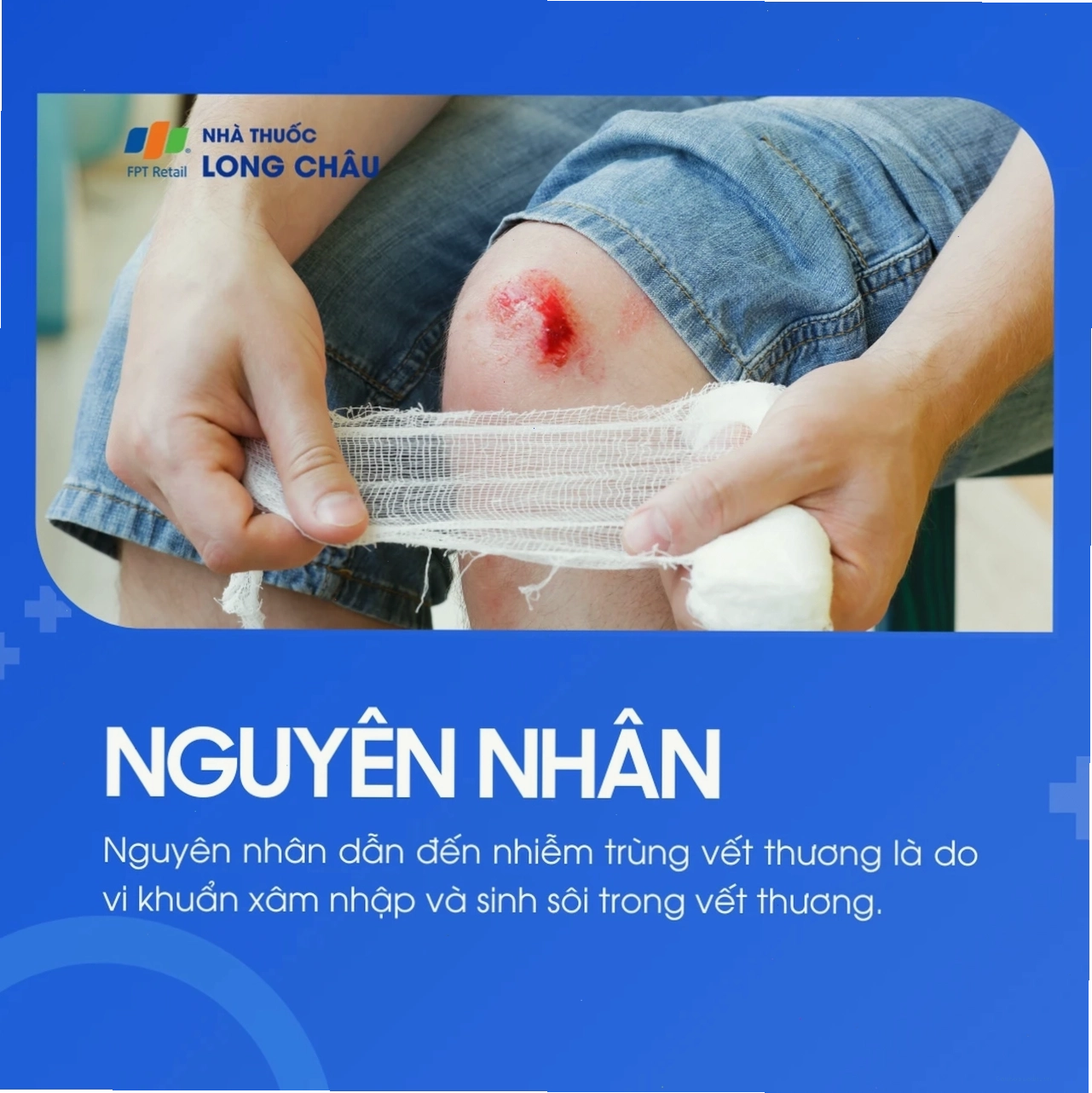Sử dụng gạc vô trùng để băng bó vết thương