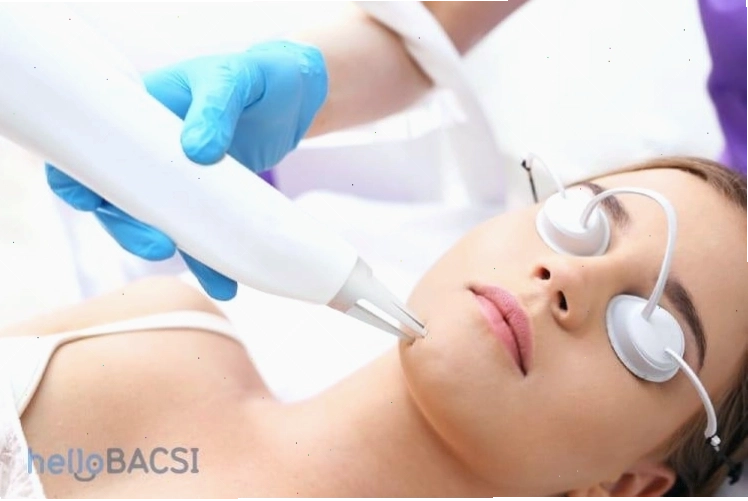 Sử dụng kem trị sẹo chứa silicone để làm mờ sẹo