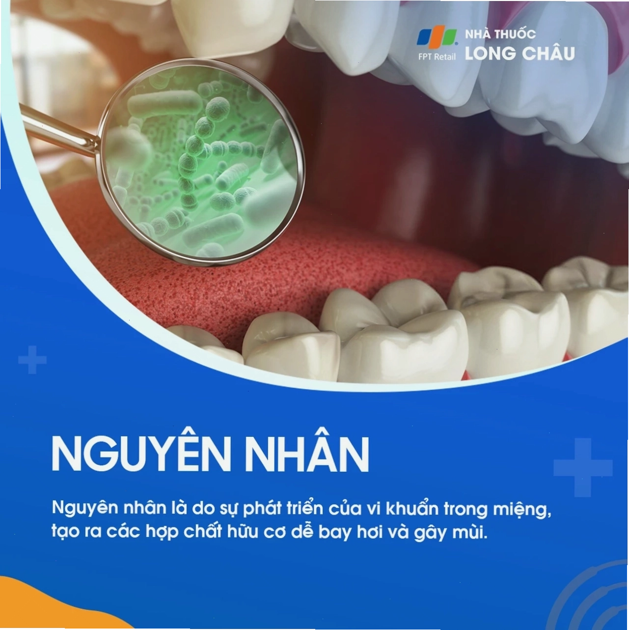 Sử dụng nước súc miệng để bảo vệ răng miệng