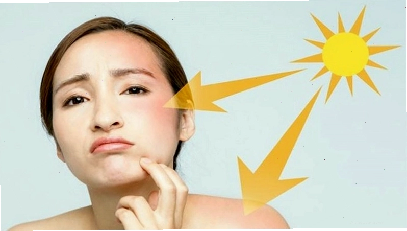 Tầm quan trọng của kem chống nắng trong việc bảo vệ da
