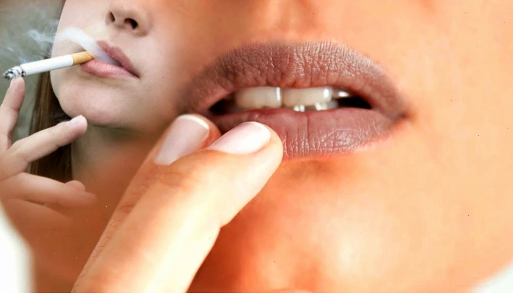 Thói quen hút thuốc lá là nguyên nhân hàng đầu gây môi thâm