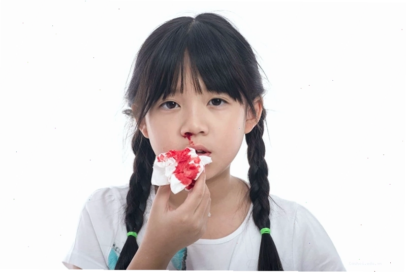 Trẻ em thường bị chảy máu mũi nhiều hơn người lớn