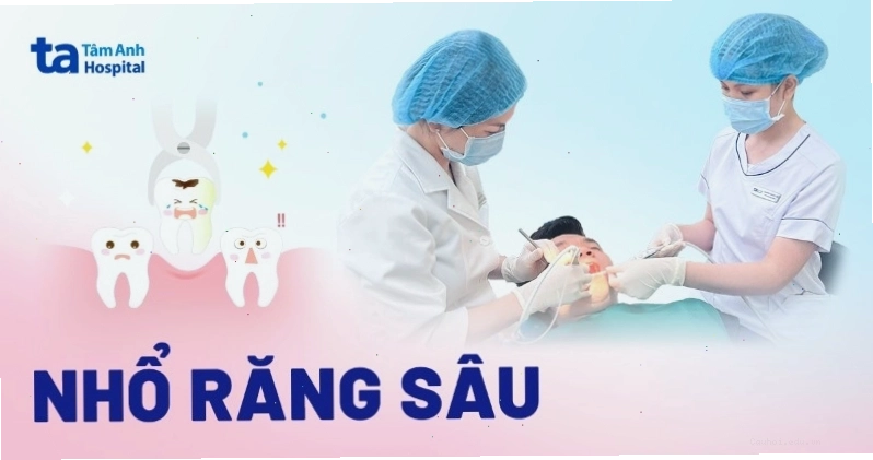 Trường hợp cần nhổ răng sâu, quy trình và lưu ý