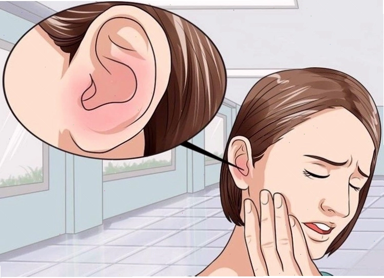 Ù tai gây cảm giác khó chịu do tiếp xúc tiếng ồn