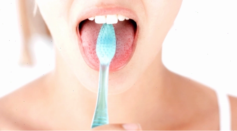 Vệ sinh răng miệng kém là nguyên nhân chính gây lưỡi trắng