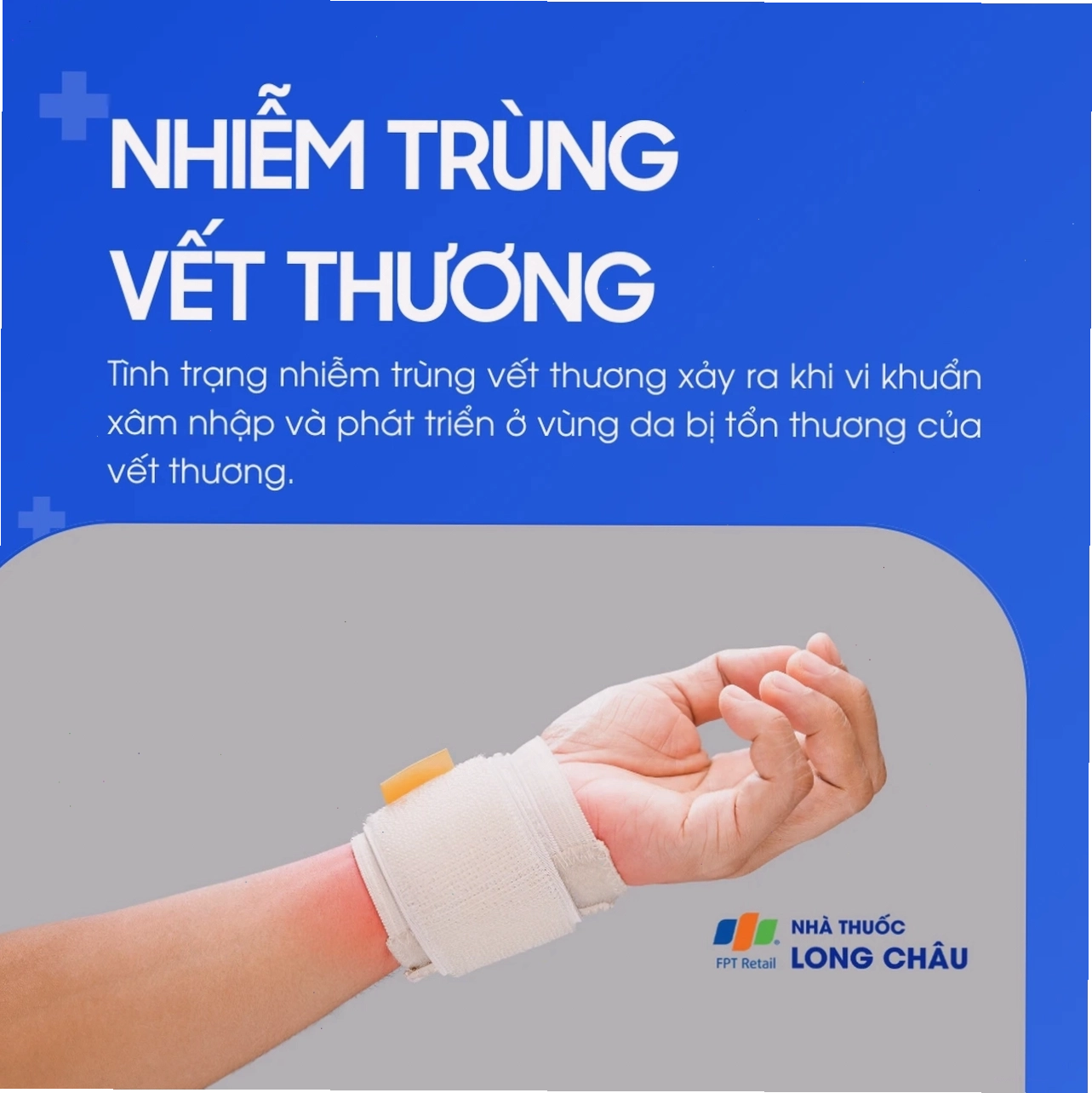 Vết thương bị nhiễm trùng có biểu hiện sưng đỏ và chảy mủ