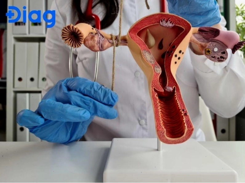 Viêm âm đạo gây ra máu nâu