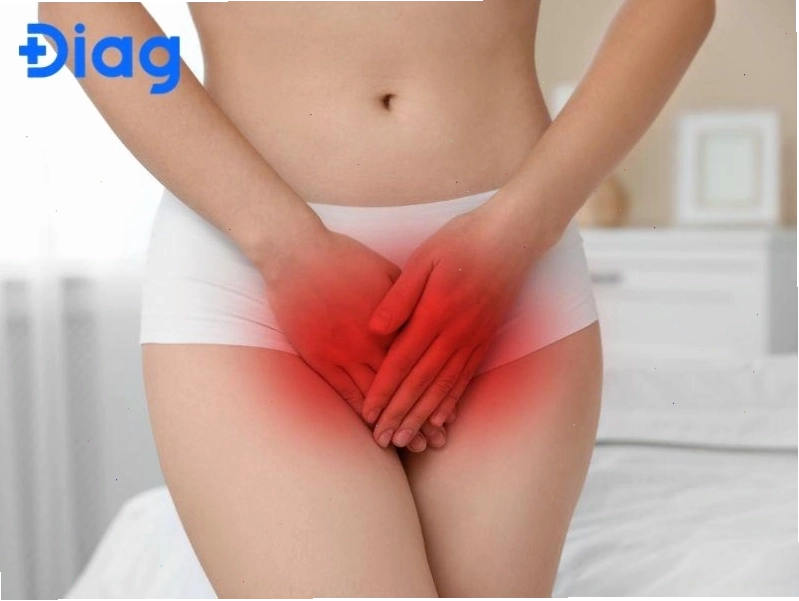 Viêm cổ tử cung gây ra máu nâu
