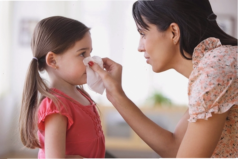 Xử trí khi trẻ bị chảy máu cam đúng cách