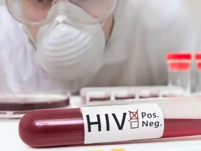 Xét nghiệm HIV ở đâu để đảm bảo an toàn và uy tín?