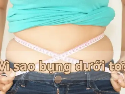 Vì sao bụng dưới to? Giải mã nguyên nhân và bí quyết giảm mỡ hiệu quả