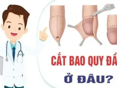 Cắt bao quy đầu ở đâu uy tín? Giải đáp thăc mắc cho bạn