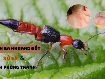 Kiến ba khoang đốt có nguy hiểm không? Xử lý và phòng tránh hiệu quả