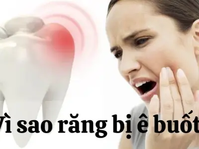 Vì sao răng bị ê buốt? Những nguyên nhân phổ biến và cách khắc phục hiệu quả