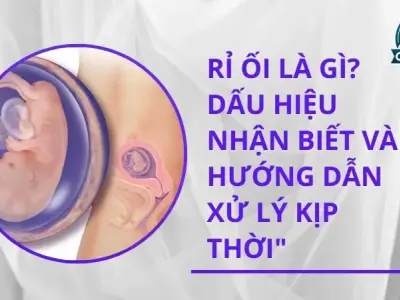 Rỉ ối là gì? Dấu hiệu nhận biết và hướng dẫn xử lý kịp thời"
