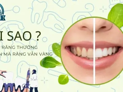 Đánh răng thường xuyên mà răng vẫn vàng - Giải pháp cải thiện bằng thiên nhiên