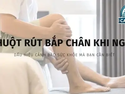 Chuột rút bắp chân khi ngủ - Dấu hiệu cảnh báo sức khỏe bạn cần biết