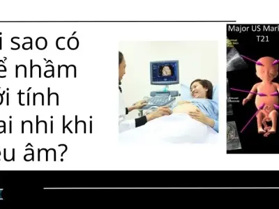 Nguyên nhân tại sao thường nhầm giới tính từ trai sang gái