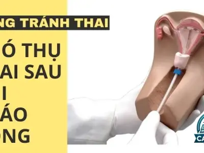 Tìm hiểu về vòng tránh thai - Nguyên nhân khó thụ thai sau khi tháo vòng