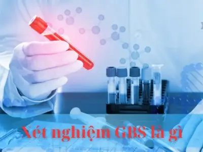 Xét nghiệm GBS là gì? Chìa khóa bảo vệ mẹ và bé khỏi nguy cơ nhiễm trùng 