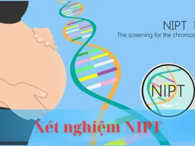 Xét nghiệm NIPT là gì ? Phương pháp sàng lọc thai nhi