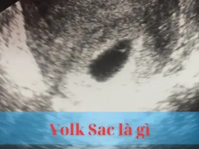 Yolk Sac là gì ? Giải đáp thắc mắc sự phát triển phôi thai