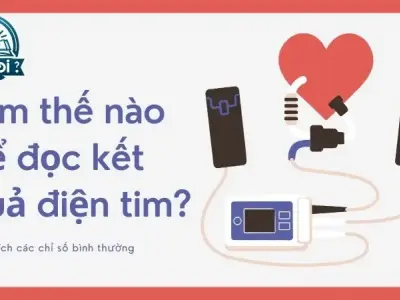 Kết quả điện tim như thế nào là bình thường? Làm thế nào để đọc kết quả điện tim? 