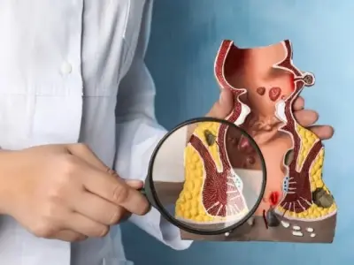 Khám trĩ như thế nào - Quy trình khám trĩ chi tiết từng bước