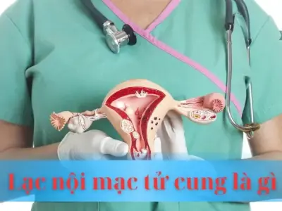 Lạc nội mạc tử cung là gì? Nguyên nhân và cách điều trị hiệu quả