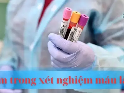 Lym trong xét nghiệm máu là gì? Ý nghĩa và tầm quan trọng
