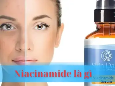 Niacinamide là gì? Siêu dưỡng chất cho làn da sáng mịn