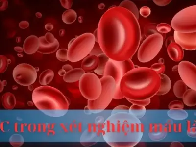 RBC trong xét nghiệm máu là gì? Giải mã bí ẩn về hồng cầu
