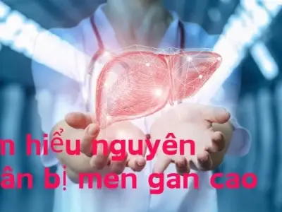 Tìm hiểu nguyên nhân bị men gan cao - Cách điều trị và phòng ngừa