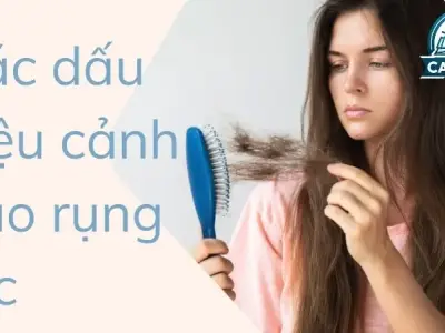 Các dấu hiệu cảnh báo rụng tóc và cách ngăn ngừa kịp thời