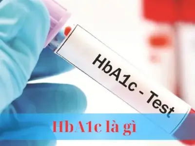 HbA1c là gì? Chỉ số quan trọng cho người bị bệnh tiểu đường