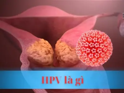 HPV là gì? Giải mã bí ẩn về virus gây bệnh nguy hiểm