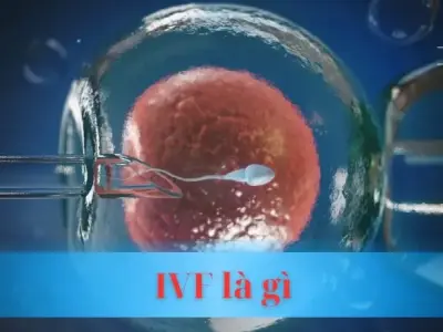 IVF là gì? Phương pháp hỗ trợ sinh sản tiên tiến