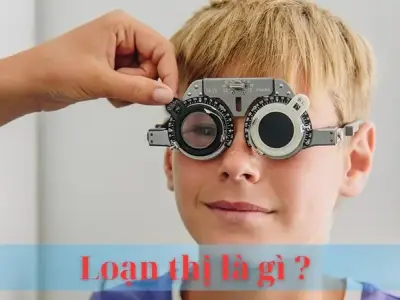 Loạn thị là gì? Nguyên nhân, triệu chứng và cách điều trị hiệu quả