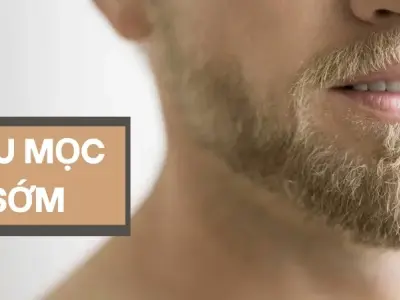 Tại sao râu mọc sớm? Những ảnh hưởng đến sức khỏe 