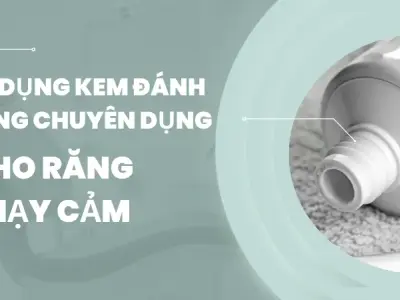 Top 5 cách trị ê buốt răng được nhiều người tin dùng