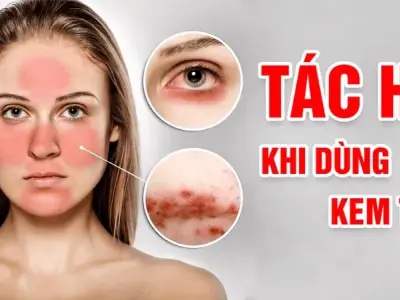 Tác hại kem trộn khiến bạn bất ngờ choáng váng
