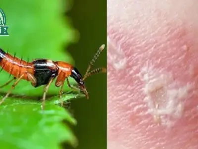 Tác hại của kiến 3 khoang - Những điều lưu ý để bảo vệ gia đình