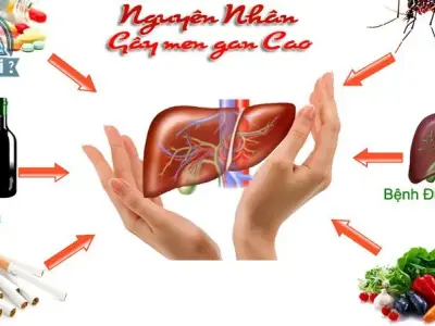 Tác hại của men gan cao - Nguyên nhân và cách khắc phục