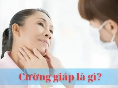 Cường giáp là gì? Nguyên nhân, triệu chứng và cách điều trị