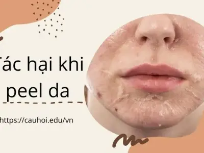Khám phá tác hại peel da - Lời cảnh tỉnh từ các chuyên gia