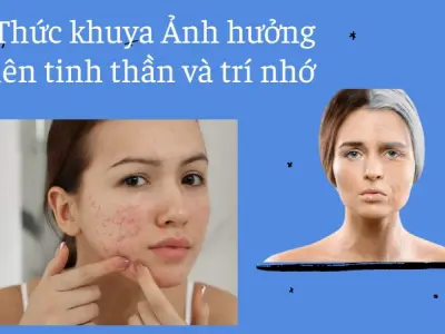 Thức khuya bao nhiêu là nguy hiểm? Các dấu hiệu cảnh báo
