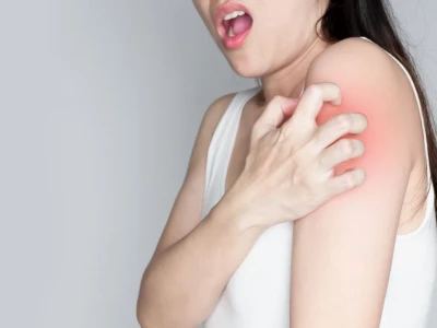 Bệnh ghẻ: Nguyên nhân, dấu hiệu và cách điều trị hiệu quả