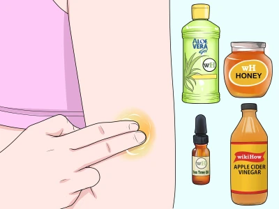 Cách làm bong vảy vết thương nhanh chóng và hiệu quả