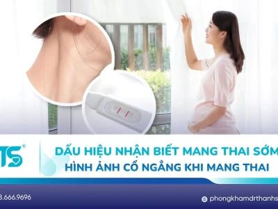 Cổ giật có phải là dấu hiệu mang thai Sớm không?
